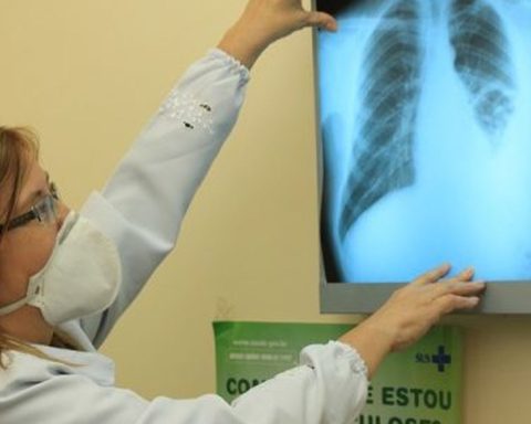 Brazil is against the WHO goal for the extinction of tuberculosis