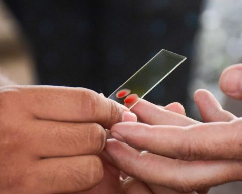 Health detects in Chiapas the first human case of myiasis by cheeking worm