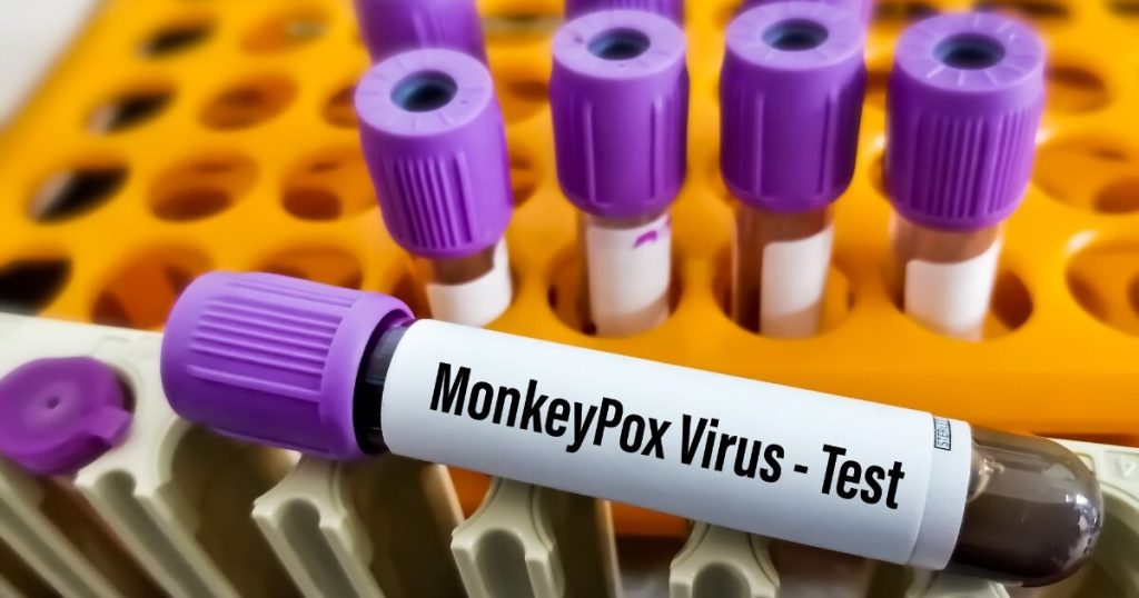 Jalisco Secretary of Health confirms First Death by MPOX in 2025