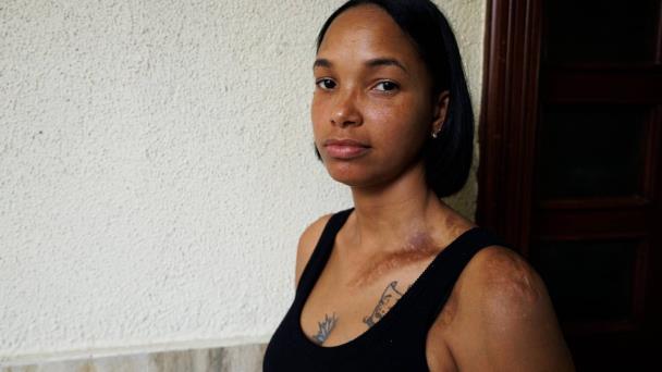 Yoselin Sánchez, victim of attempted feminicide asks for justice