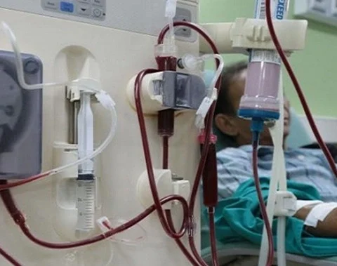 hemodiálisis, Cuba, crisis