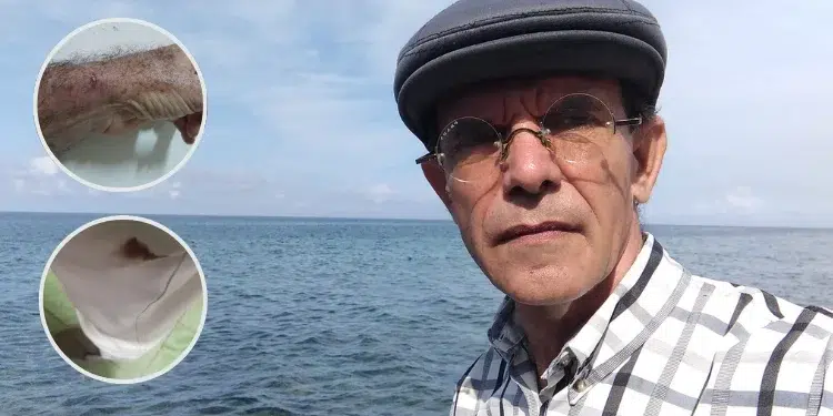 Fernández Era fue lesionado durante el forcejeo para trasladarlo a l fuerza este lunes