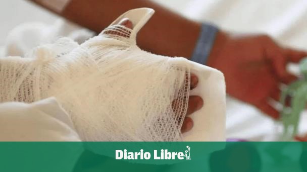 How is the girl burned by another in Santo Domingo Este?