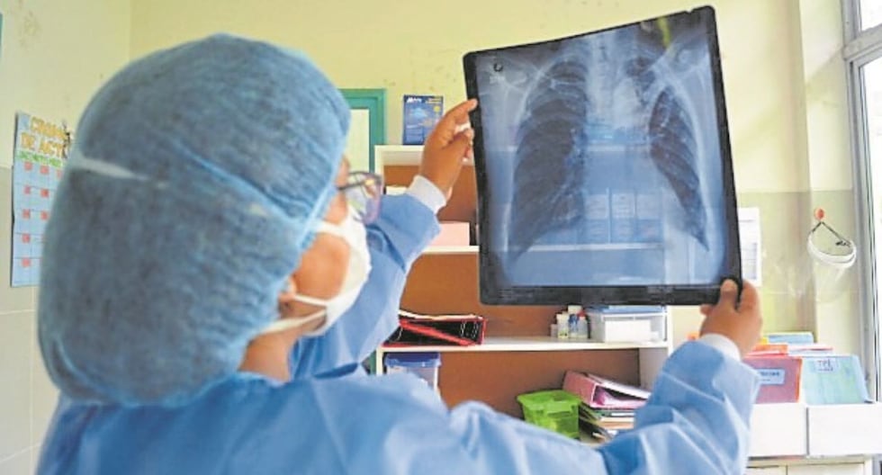 Trujillo: Alarm for three cases of tuberculosis in public schools