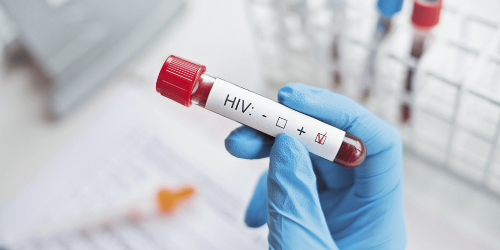 UN warns possible agency closure against HIV due to lack of funds in 2026