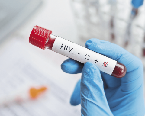 UN warns possible agency closure against HIV due to lack of funds in 2026