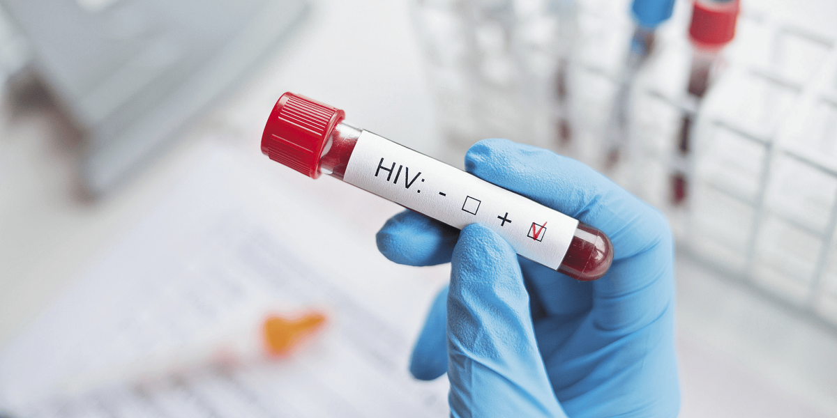 UN warns possible agency closure against HIV due to lack of funds in 2026