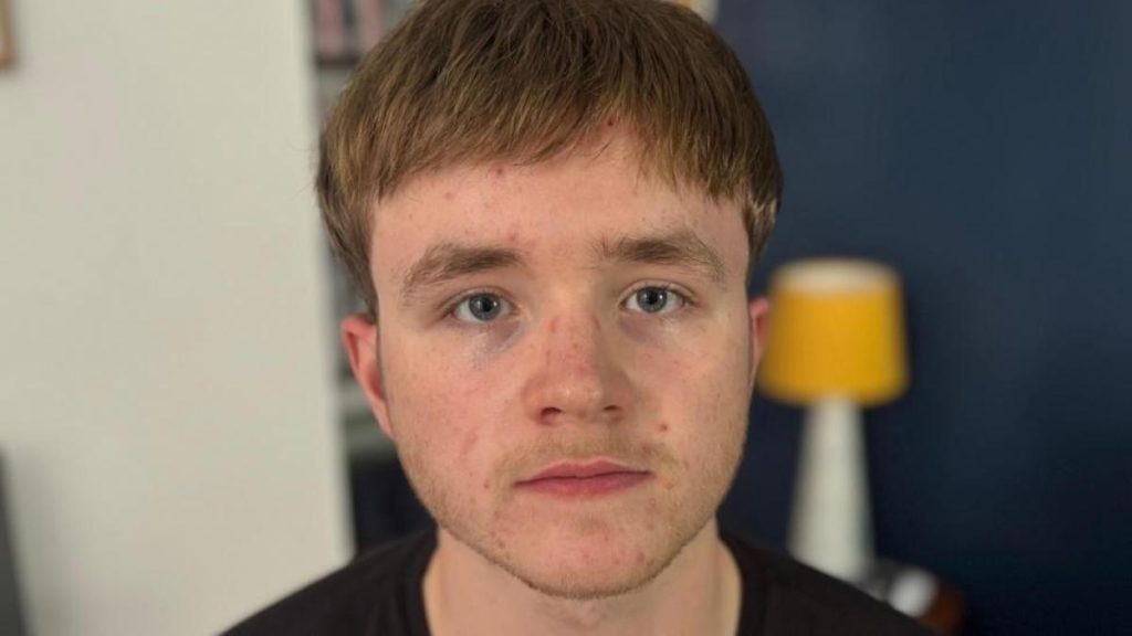 "I began to lose my hair at age 16 and that took control of my life completely"