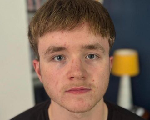 "I began to lose my hair at age 16 and that took control of my life completely"