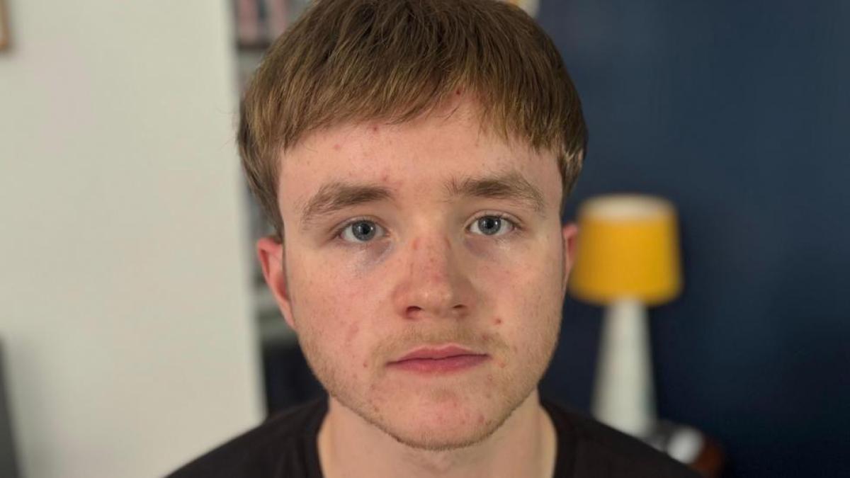 "I began to lose my hair at age 16 and that took control of my life completely"