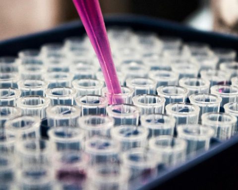 Brazilian research advances in the diagnosis of Alzheimer’s