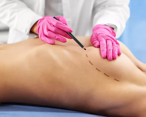 Breast cancer: How to detect early signs according to the lawy law walls