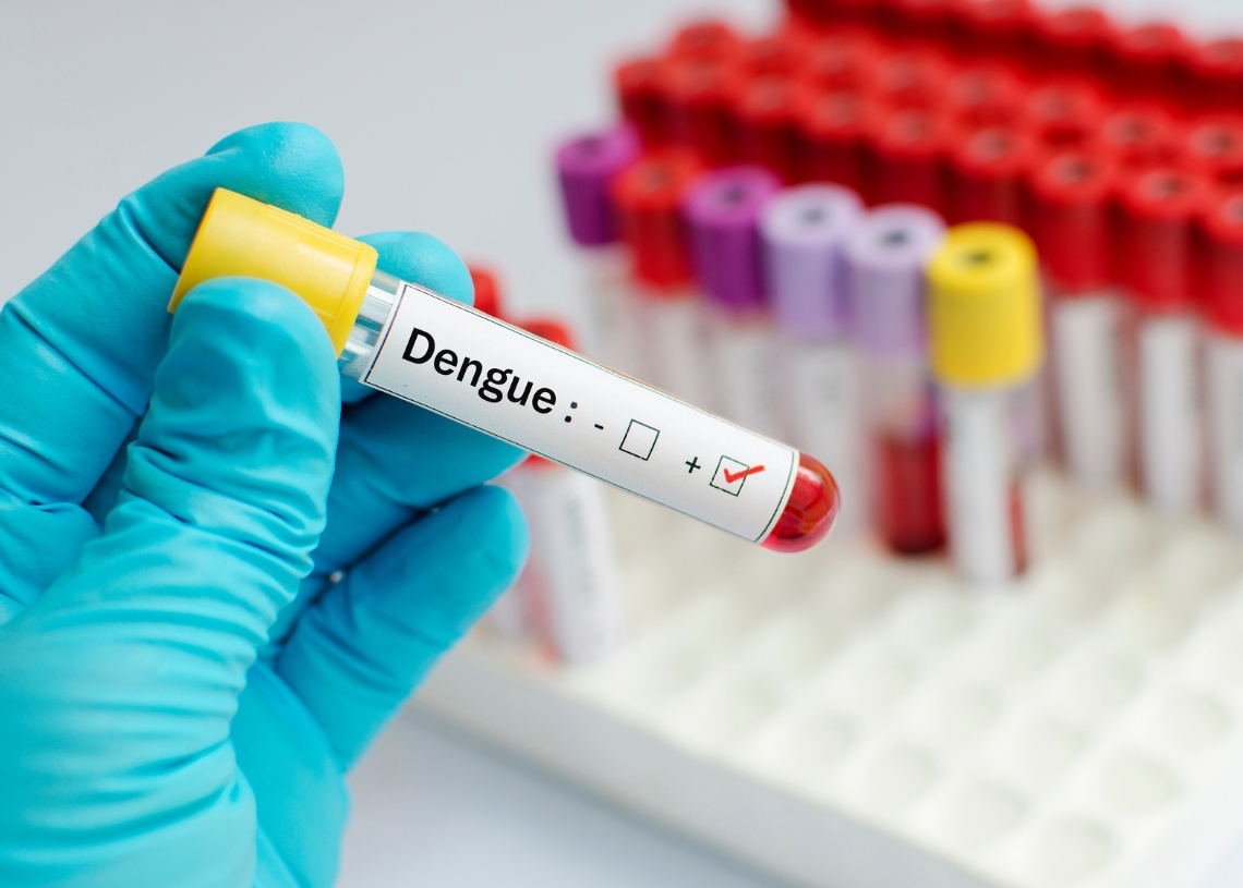 Cuba faces the increase in dengue, chikunguña and oropouche