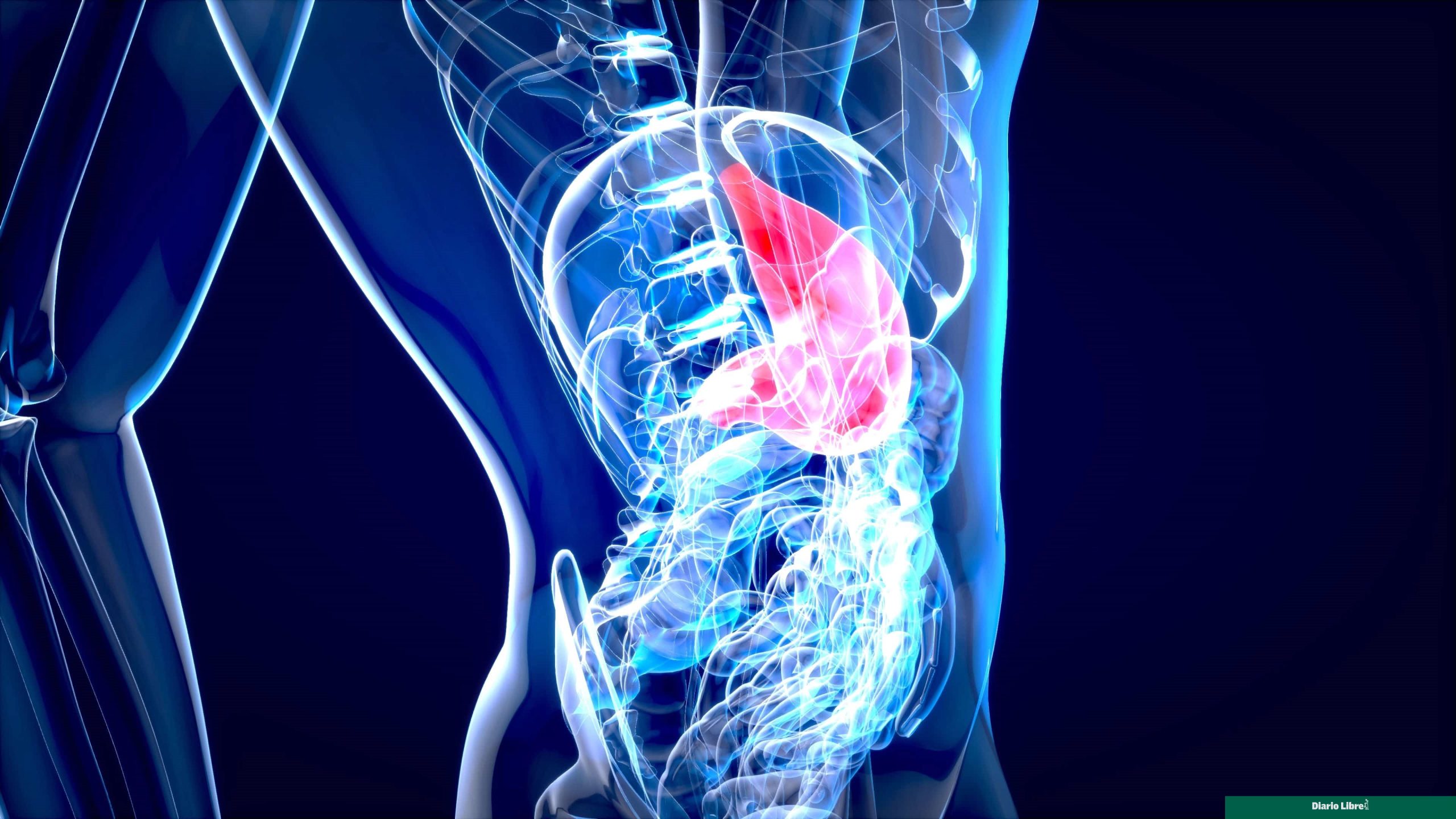 New hydrogel prevents complications after abdominal surgeries