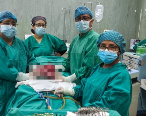 They remove more than two kilos of tumors from the mother and save her life at the EsSalud La Oroya hospital