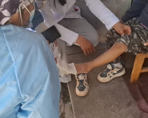 Health personnel without gloves in checkup for coxsackie virus