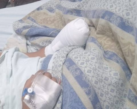 Huancayo: Minor who lost his left hand requires comprehensive psychological support
