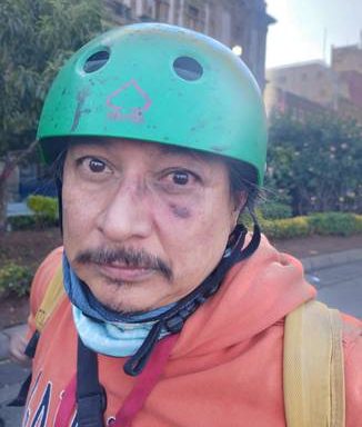 Police attack photojournalist; It was collateral damage: Pablo Vázquez
