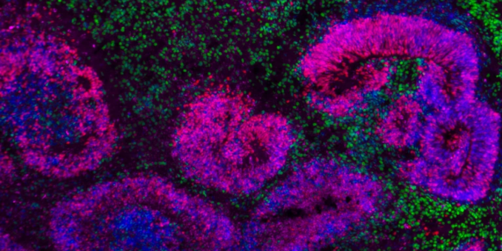 Scientists present the first draft of the atlas of the developing brain