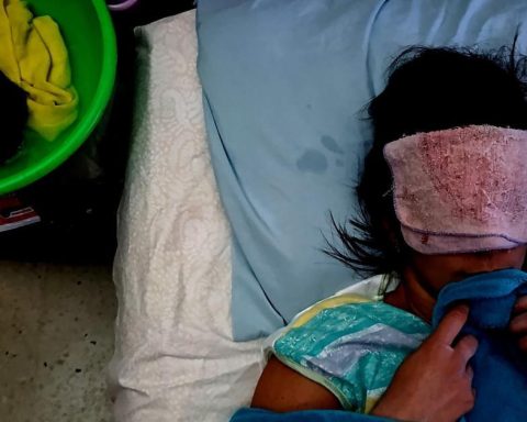 The lethality of the epidemic is "incompatible" with chikungunya, Cuban doctors point out