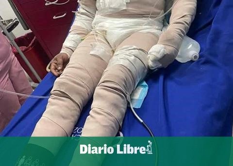 Woman arrested for causing burns to her partner