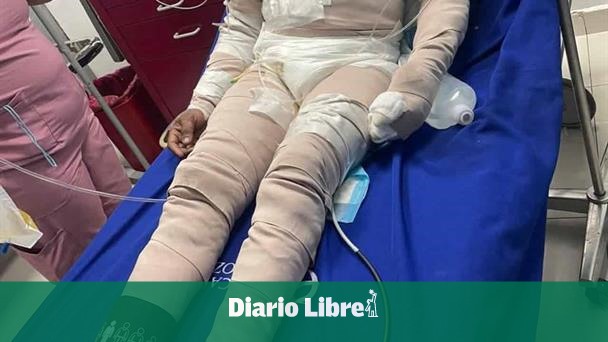 Woman arrested for causing burns to her partner