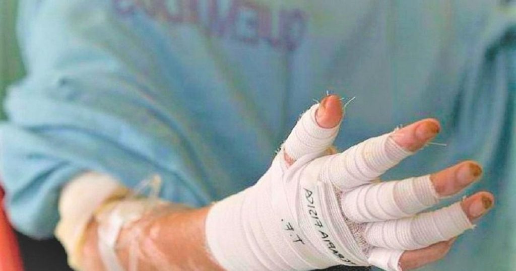 Antioquia leads the number of people burned by gunpowder in Colombia: 90 people injured