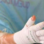 Antioquia leads the number of people burned by gunpowder in Colombia: 90 people injured