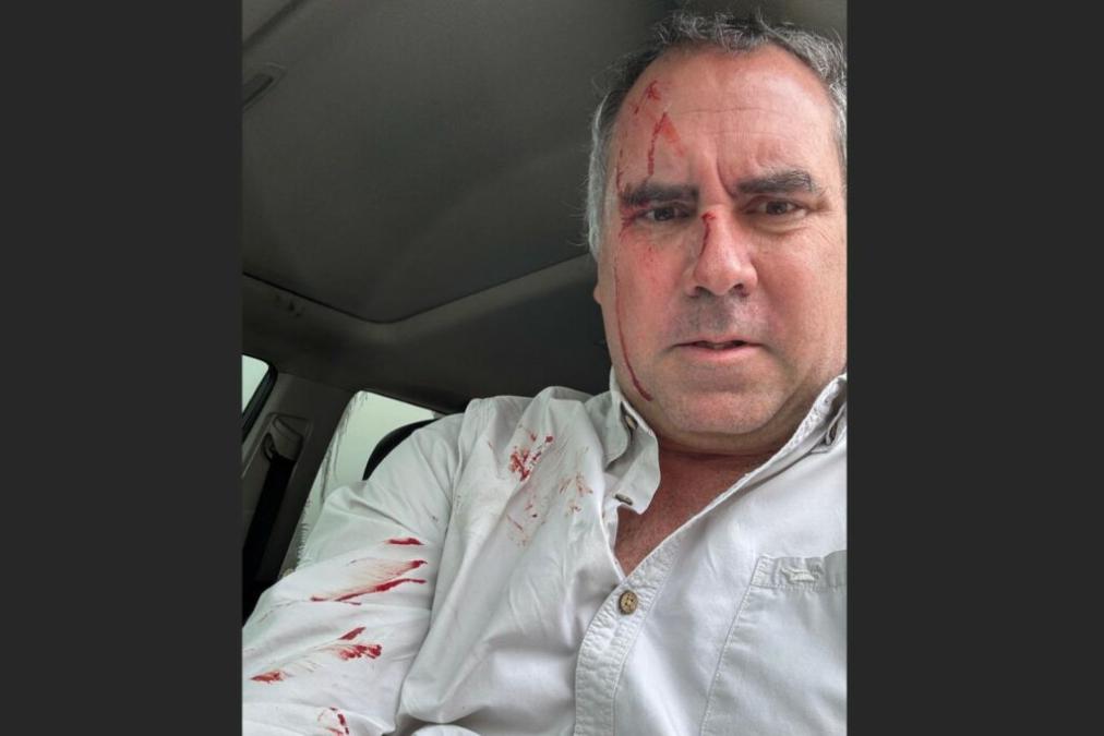 Frankly discussing security