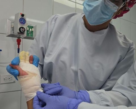 Hot liquids cause 44% of burns and saturate specialized units in Antioquia