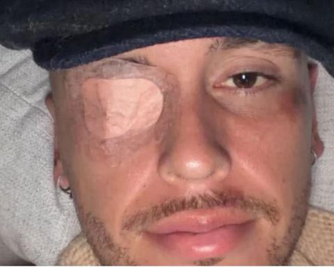 Lucas Ocampos suffers facial paralysis