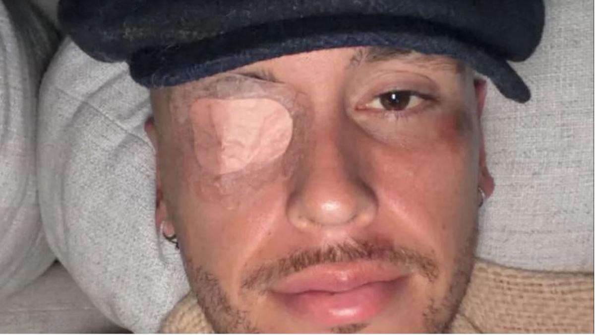 Lucas Ocampos suffers facial paralysis