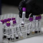 Peru participates in clinical trials for an HIV vaccine from San Marcos
