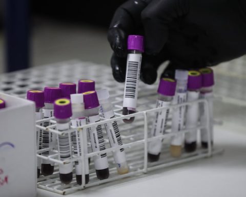 Peru participates in clinical trials for an HIV vaccine from San Marcos