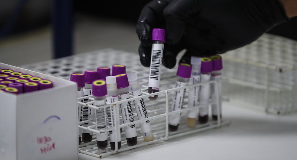 Peru participates in clinical trials for an HIV vaccine from San Marcos