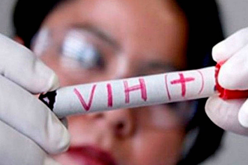 Solidarity Action: Almost 40% of people with HIV in Venezuela do not know their diagnosis