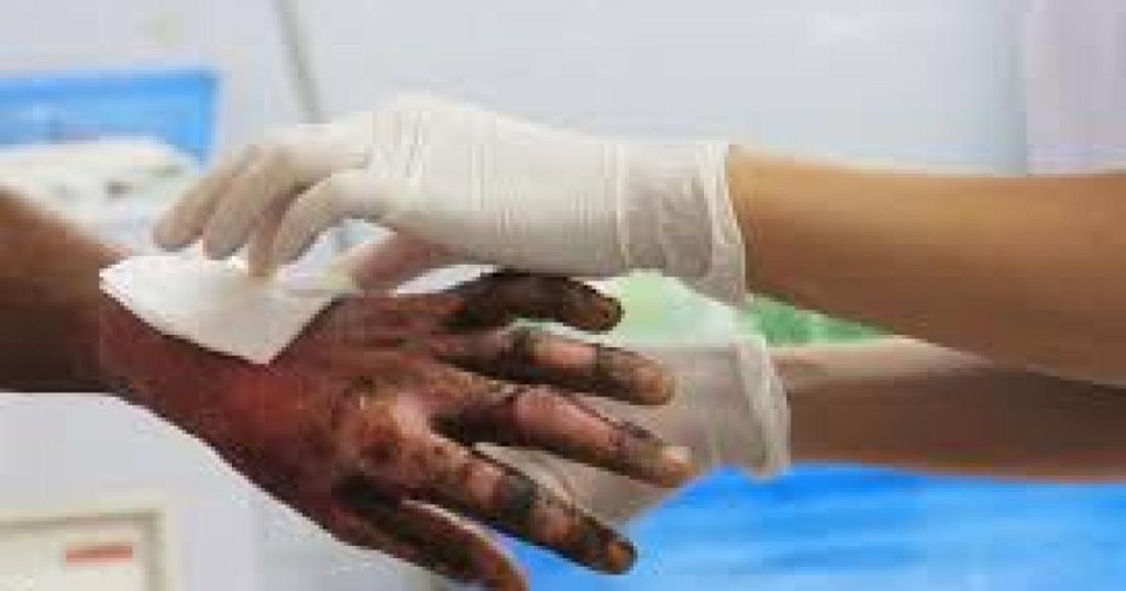 There are already 61 people affected by gunpowder so far in December