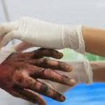 There are already 61 people affected by gunpowder so far in December