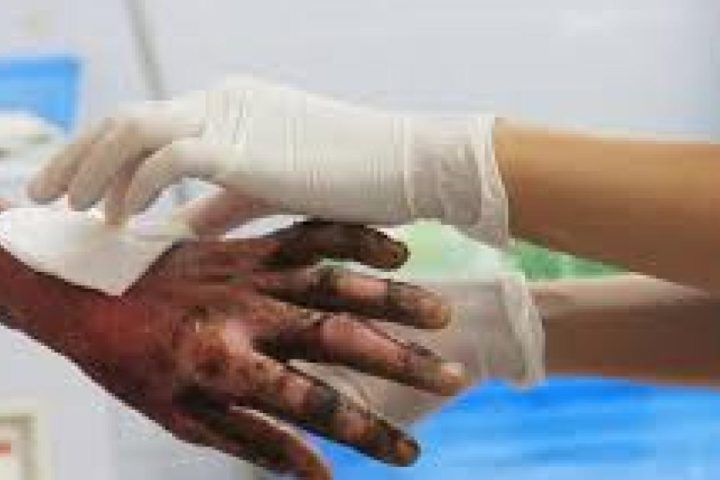 There are already 61 people affected by gunpowder so far in December