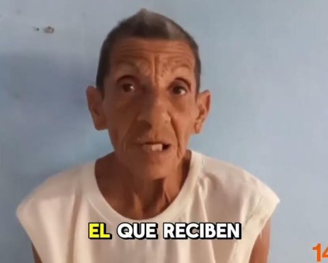 When smiling and chewing cost 20,000 pesos