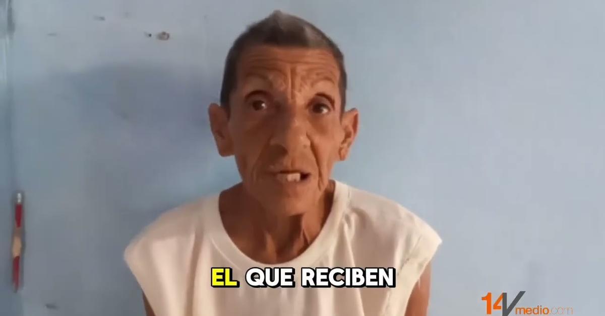 When smiling and chewing cost 20,000 pesos