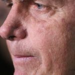 With a persistent bout of hiccups, Bolsonaro undergoes new surgery