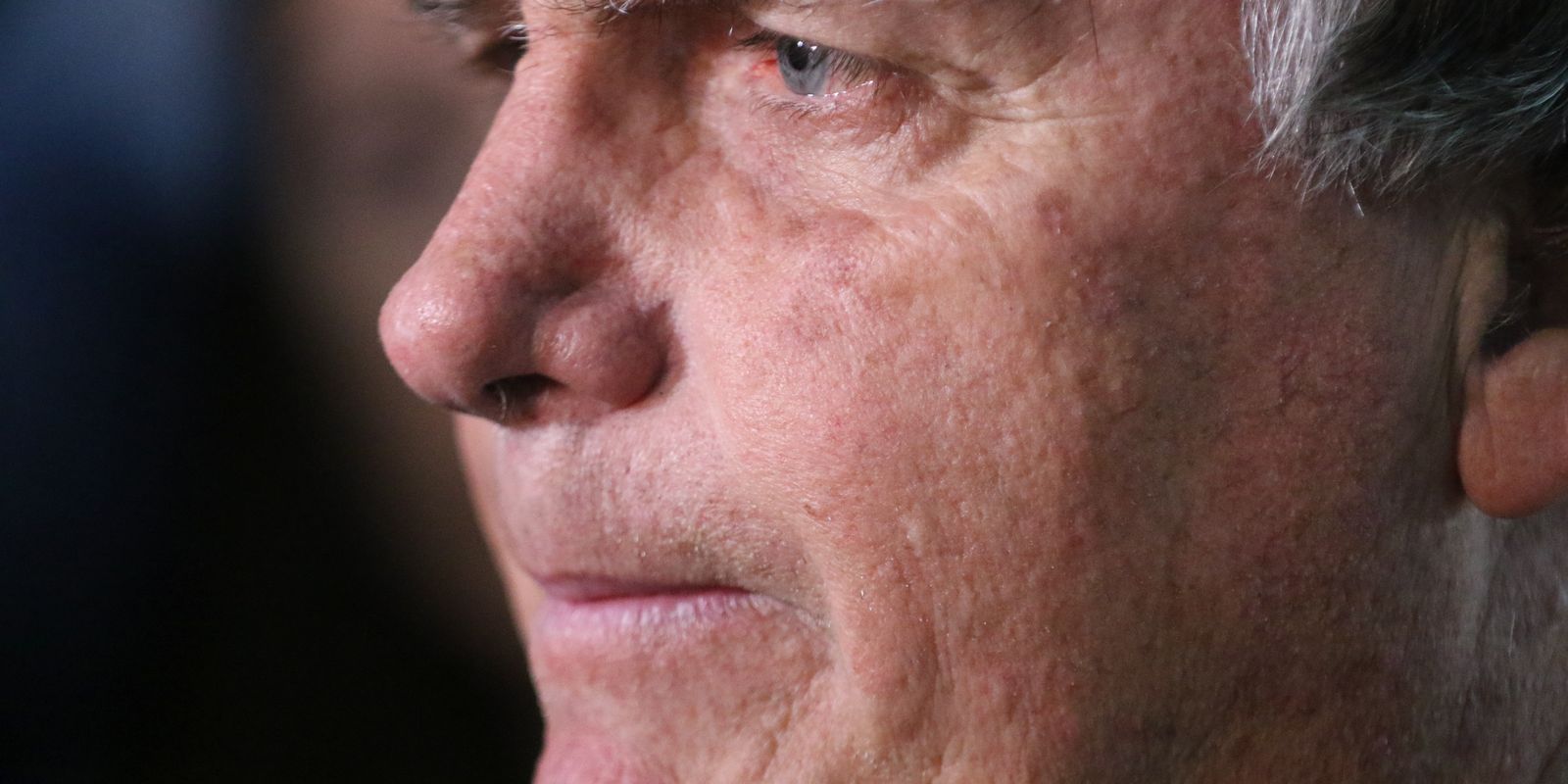 With a persistent bout of hiccups, Bolsonaro undergoes new surgery