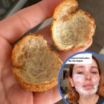 Joven que se quemó haciendo buñuelos.