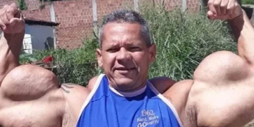 Arlindo de Souza, known as "Brazilian Popeye"