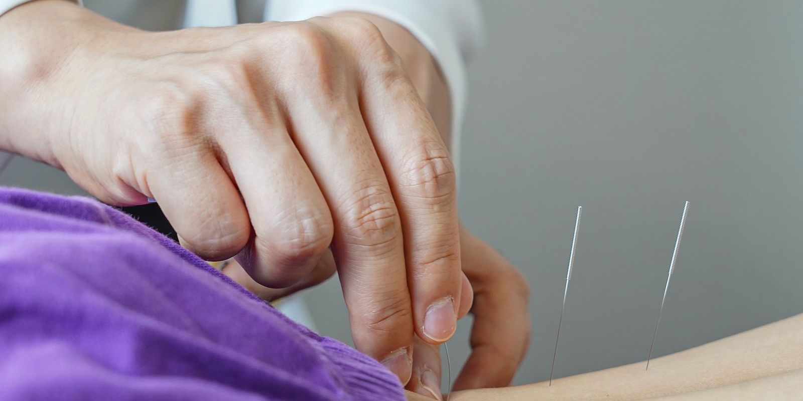 Brazil regulates professional practice of acupuncture