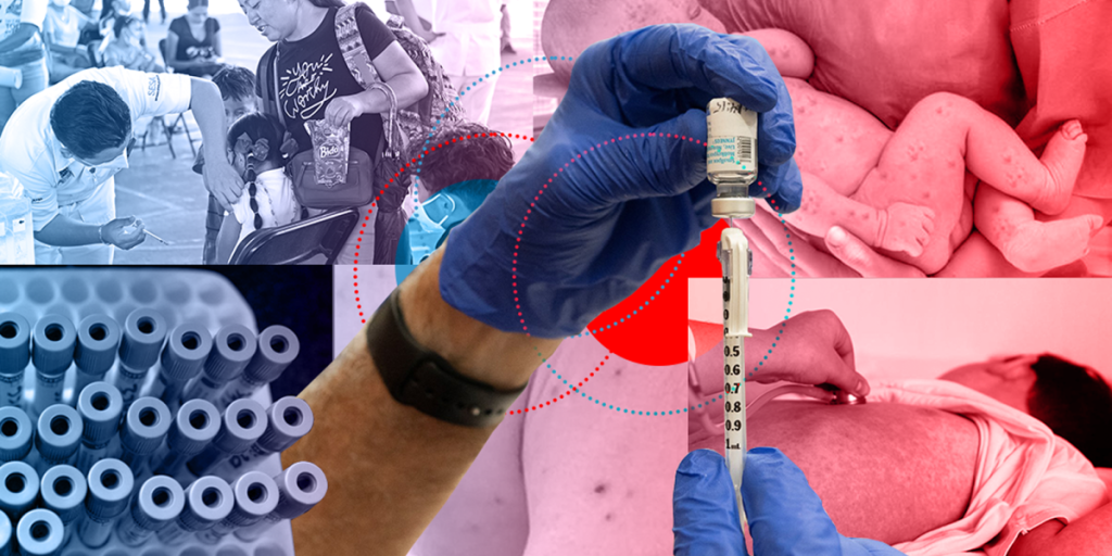 Mexico closed 2025 with the largest measles outbreak and the first place in whooping cough deaths in America