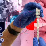 Mexico closed 2025 with the largest measles outbreak and the first place in whooping cough deaths in America