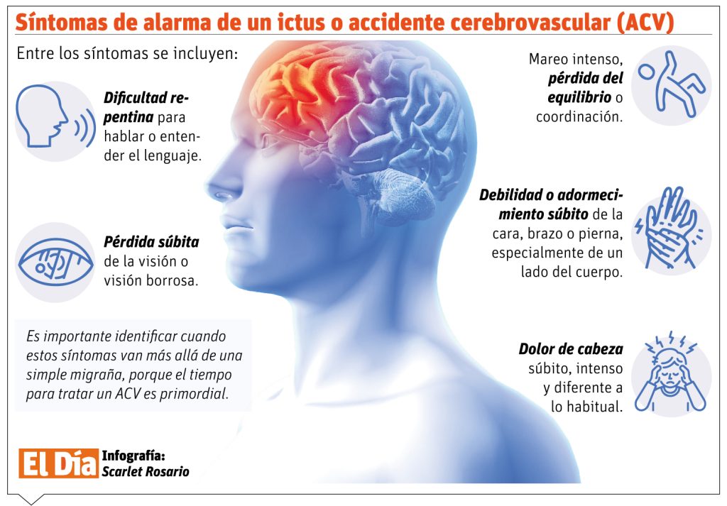 Migraine and stroke risk: a relationship that deserves medical attention