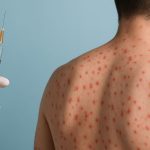 PAHO summons Mexico to evaluate whether it maintains its status as a measles-free country